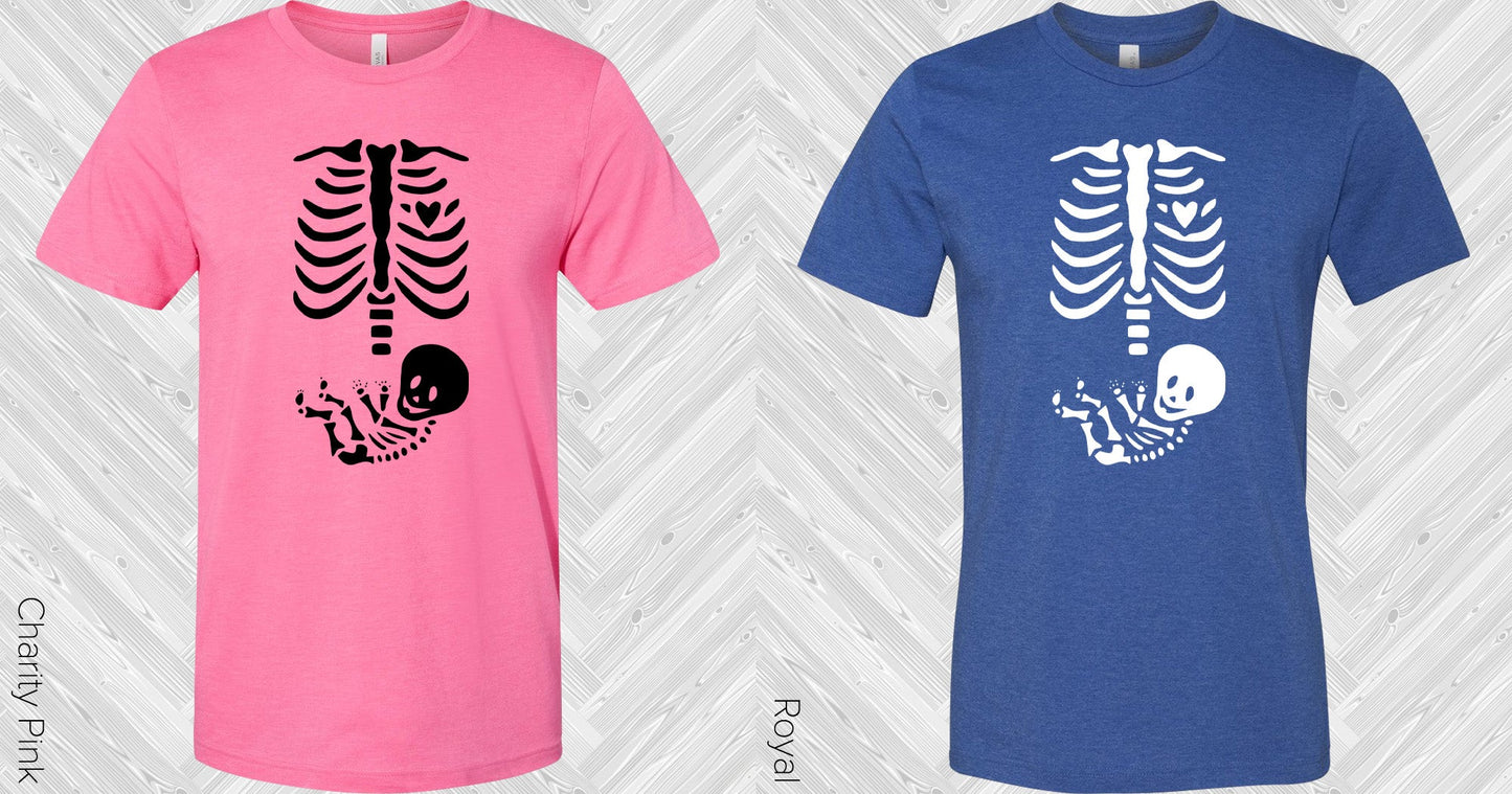 Skeleton Baby Graphic Tee Graphic Tee